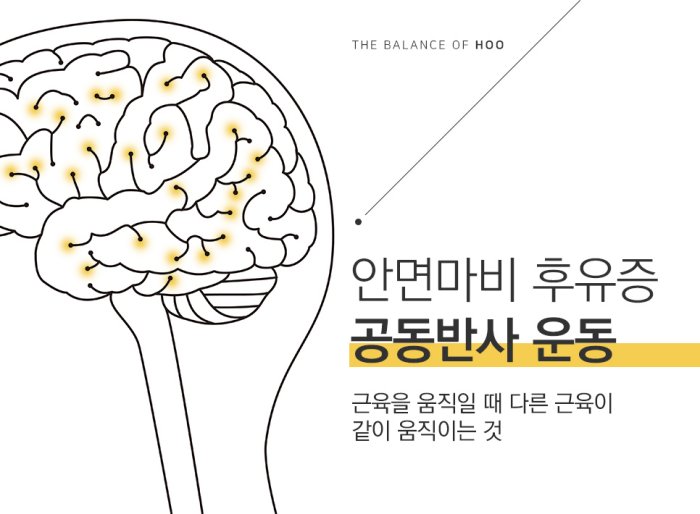 안면마비 후유증 - 공동반사운동 설명 다이어그램