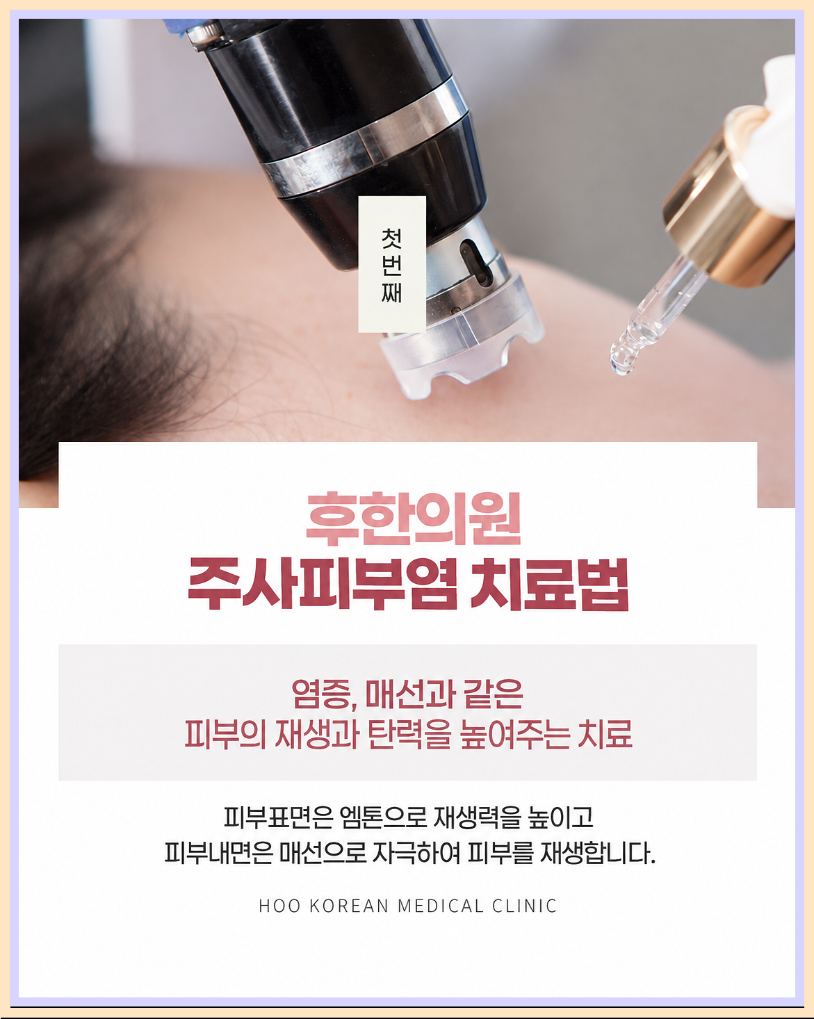 부산피부질환 주사피부염 치료 방법 하나