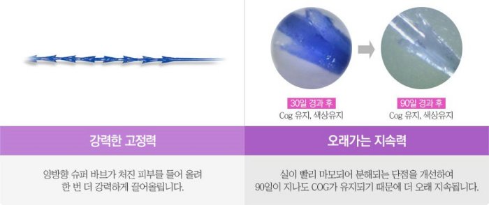 매선요법에 사용하는 돌기형 실의 고정력과 지속력 안내 이미지