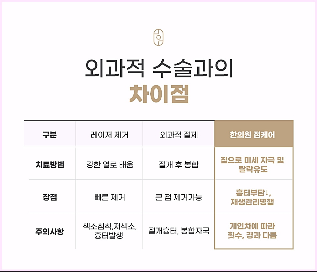 부산점제거 레이저 제거, 외과적 절제, 한의원 점케어의 치료방법·장점·주의사항 비교