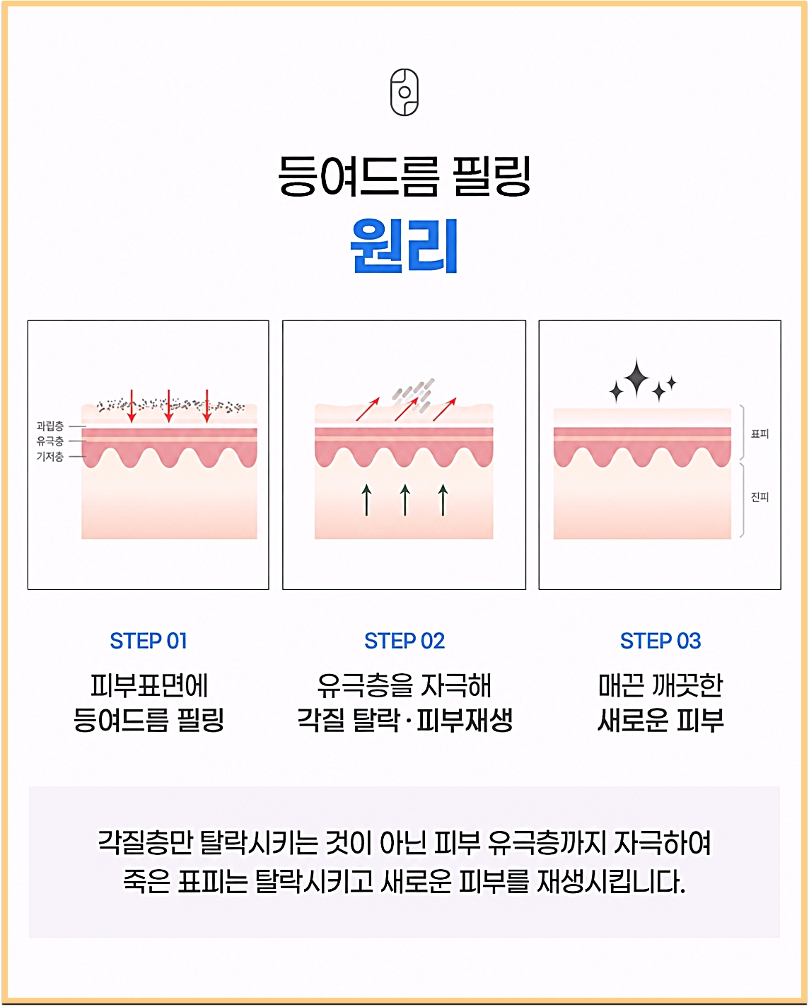 부산등드름 치료 시 후윤약초필링으로 묵은 각질이 탈락하고 새 피부가 재생되는 과정