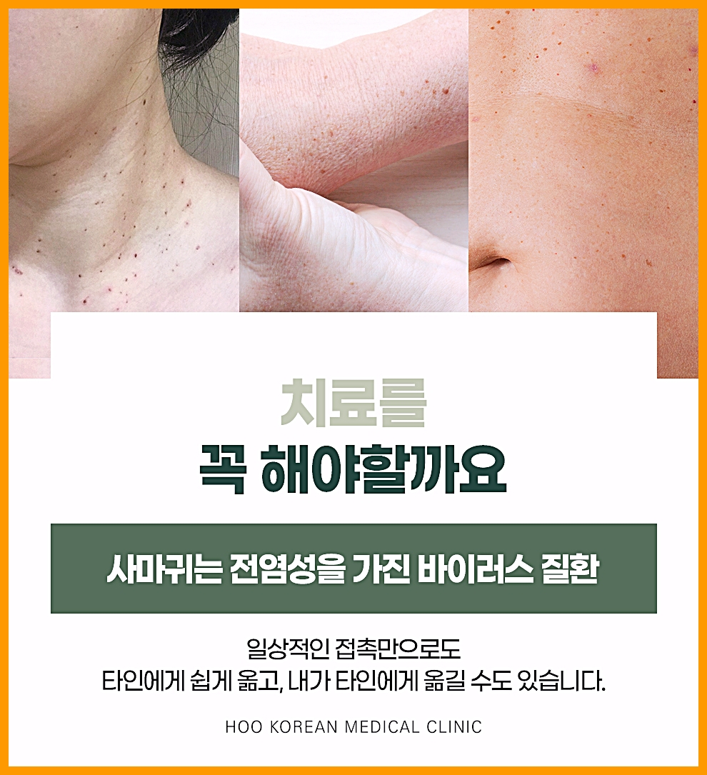 부산편평사마귀 전염성 바이러스 질환, 목·팔·배에 퍼진 병변 장면