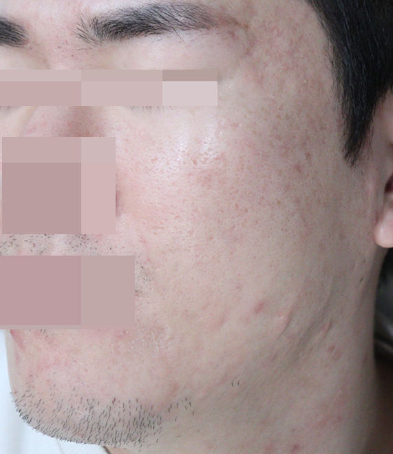 After