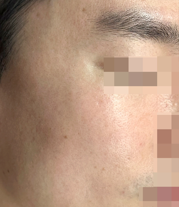 After