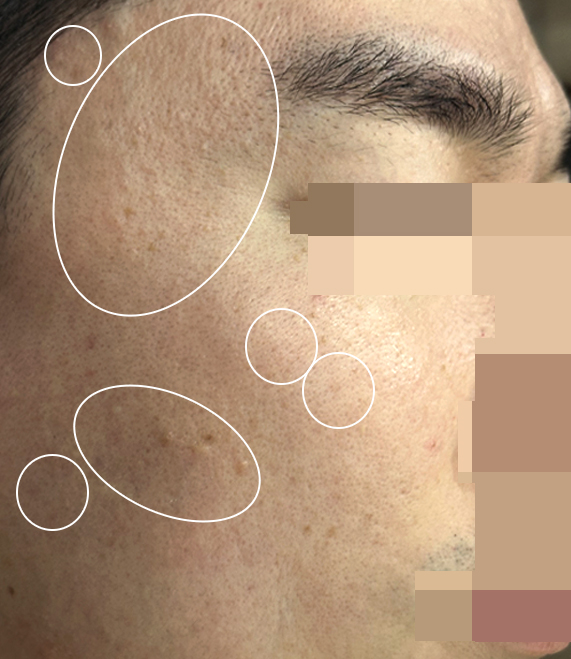 Before