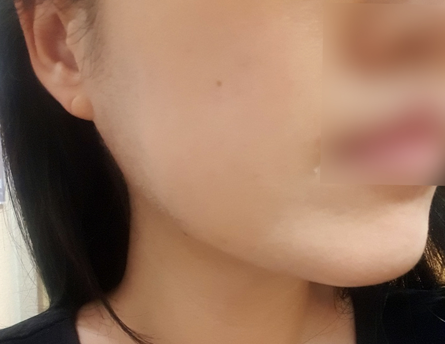 After