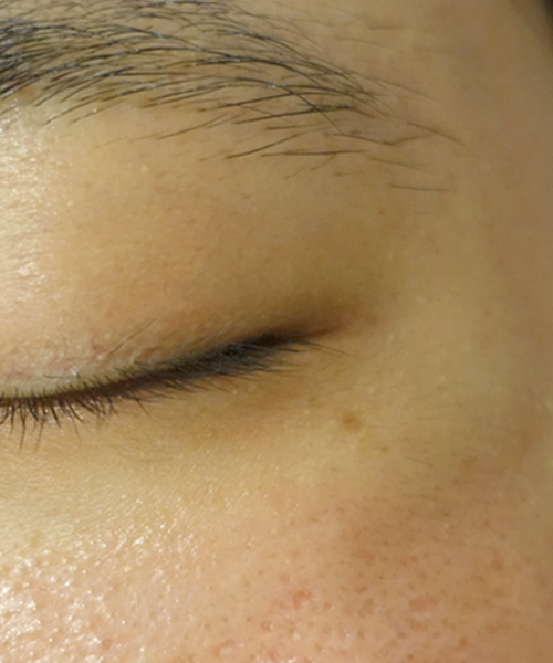 After