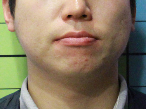 Before
