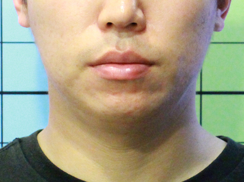 After