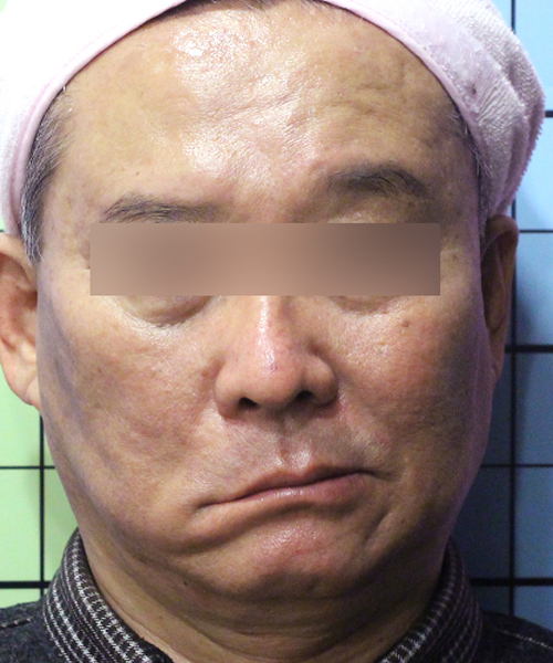 Before